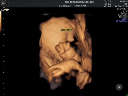 8.1K views · 135 reactions | You have to be quick to catch this baby's first bird! | The 4D Ultrasound Lady | Facebook
