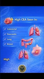 CEA blood test #blood #bloodtest #medicaltest #nurse #medicallaboratoeyscience #CEA #tumormarkers