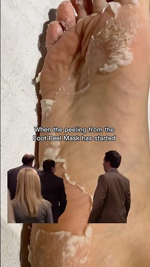 Peeling Foot Mask Results | How to Get Soft Feet in Days #shorts