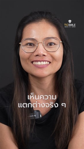 #รีวิวGBT จากผู้ใช้งานจริง GBT Airflow เหมาะกับคนที่จัดฟันอยู่ เพราะทำความสะอาดได้ล้ำลึก และช่วยให้ฟันขาวสะอาด บอกลาอาการเจ็บหรือเสียวฟันขณะขูดหินปูนไปได้เลย 🦷✨️ ทำ GBT Air Flow (แอร์โฟลว์) หรือสปาฟันดียังไง⁉ ✅ฟันขาวสะอาดขึ้น ✅ขจัดคราบติดแน่นได้ดี ✅ช่วยลดกลิ่นปาก กลิ่นบุหรี่ ✅สะดวก รวดเร็ว ปลอดภัย ไม่เจ็บ ✅สามารถขจัดคราบจุลินทรีย์ที่เป็นสาเหตุของการเกิดโรคเหงือกและโรคฟันผุได้ . Dental Spa เหมาะกับใคร? ✅ ผู้ที่ติดชา กาแฟ หรือบุหรี่ ✅ ผู้ที่ใส่ใจสุขช่องปาก ✅ ผู้ที่มีความเสี่ยงเป็นโรคปริทันต์ ✅ ผู