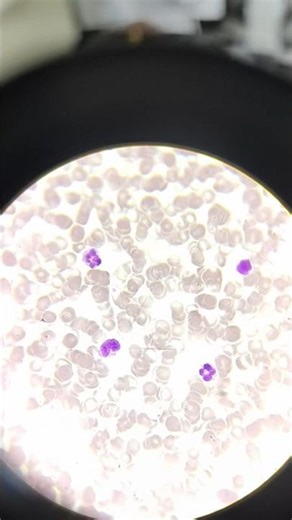 Blood slide under microscope DLC count under microscope