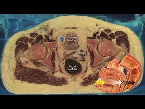 Cross Sectional Anatomy Of The Female Pelvis • Video • MEDtube.net