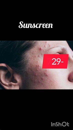 WHAT I Prescribe for Acne #pimples #dermatology #doctor