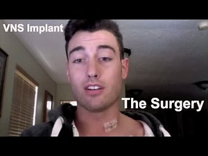 Vagus Nerve Stimulator