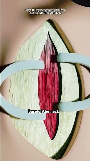 How Thyroidectomy Is Done (3D Animation)