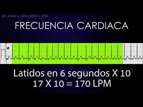 Electrocardiografía Básica (Parte 2/4)