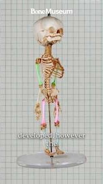 ￼ Meet Gordon: The Bone Museums fetal skeleton