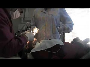 dentist dec 28th 2010 getting cavity filled part 2