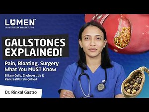 Gallstones Explained | Causes, Symptoms & When Surgery is Needed | Gallbladder Stone Guide