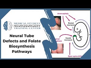 Neural Tube Defects and Folate Biosynthesis Pathways