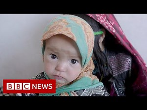 Afghan children battle malnutrition and measles as 23m face extreme hunger - BBC News