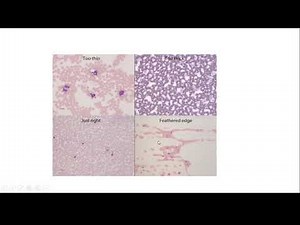 Differential WBC count