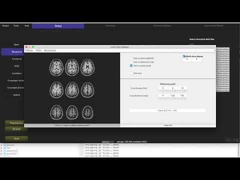 Resting state functional connectivity in CONN (#1)