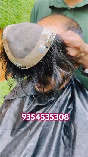 hair patch clipping method, #shorts #wigs #trending