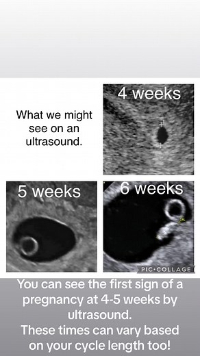 Understanding Pregnancy Ultrasound Development