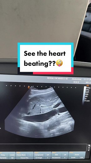 Exploring Organs on Ultrasound: A Unique Insight