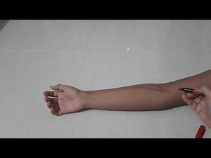 Surface Anatomy of Radial artery and Ulnar artery.