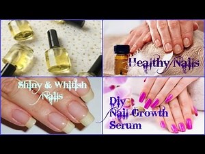 How To Grow Nail Faster || DIY Nail Growth Recipe | Healthy : Shiny & Whitish Nails