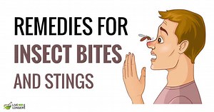 10 Best Home Remedies For Insect Bites That Offer Relief