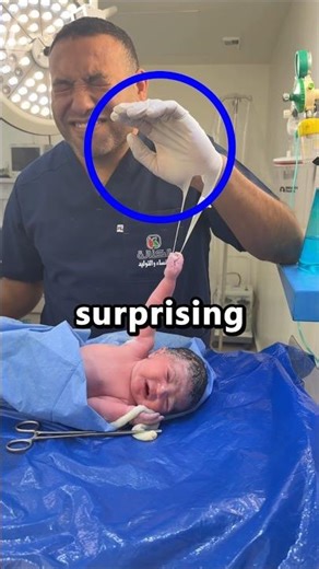 Why Newborns Have To Test Their Reflexes 🤯