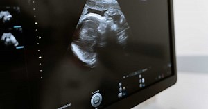 Échographie de grossesse : quand, à quelle fréquence et comment cela se passe ?