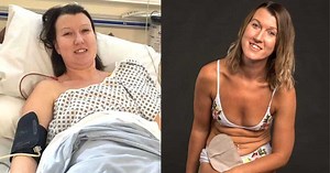 ‘I looked at the poop bag and cried. ‘I’d rather die.’ I didn’t want my partner to stop loving me.’: Woman with ulcerative colitis advocates for stomas, ‘Every body is worthy’
