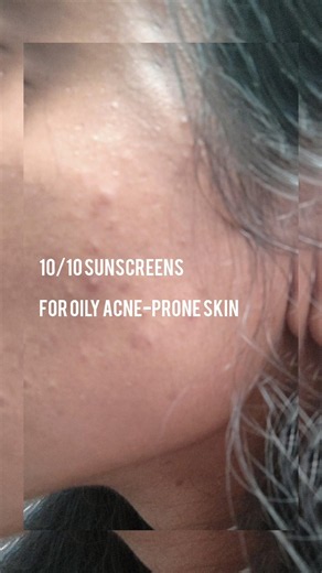 10/10 SUNSCREENS for my oily acne-prone skin #sunscreen #skincare #shorts
