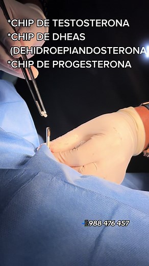 #pellet #pelletdetestosterona #chipdetestosterona #testosteronabioidentica #DHEAS#progesterona #hormonasbioidenticas