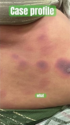 😦 OOH #viralvideo #shortvideos #youtubeshorts #youtube #generalphysician #doctor #hospital