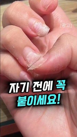 Please take care of your fingernails and toenails to keep them healthy! #WeakNails #SplitNails #N...