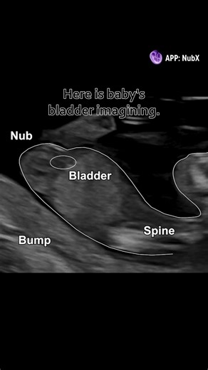 Learn your baby's gender with NubX!