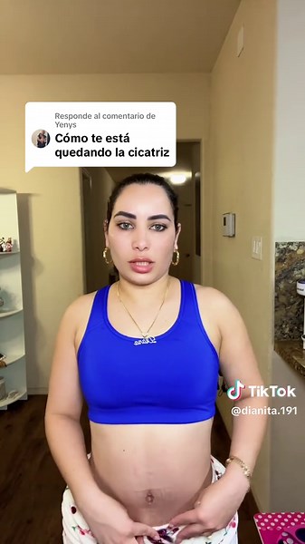 Guía Completa sobre Cirugías Plásticas y Recuperación