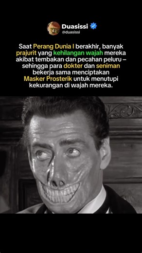 Prajurit yang kehilangan wajah saat Perang Dunia 1