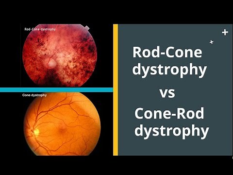 Rod Cone dystrophy VS Cone Rod dystrophy