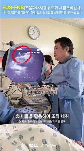 EUS-FNB (Ultrasound-Guided Fine Needle Biopsy) Procedure Scene #shorts