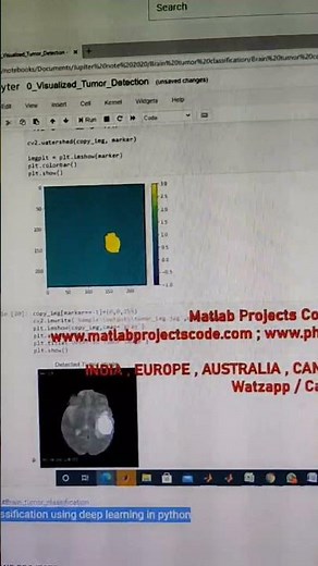 Brain tumor detection and classification using deep learning in python