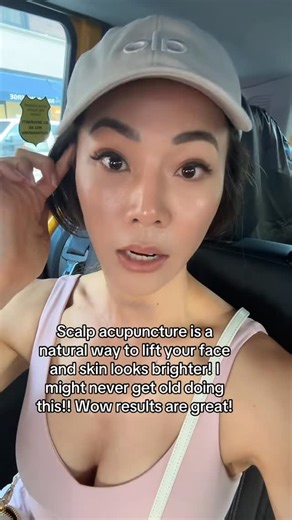 Jessica Lee on Instagram: "Scalp acupuncture = facial lift! Yep, it activates cranial nerves and boosts blood flow along meridian pathways tied to facial muscles—helping tighten, tone, and delay aging. The science is in the stimulation - so amazing! I’ve learned so much about aging and longevity from my acupuncturist and it’s just fascinating. Like did you know your kidney function is absolutely critical in determining longevity and speed of aging?! There are ways to improve your kidney function