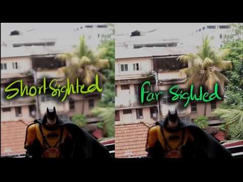 Myopia & Hypermetropia