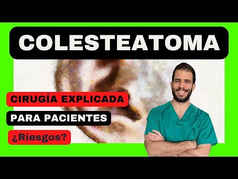 👂➡️ Cholesteatoma surgery - What are the risks and complications?