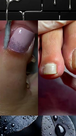 Satisfying Nail Cleaning & Callus Removal | Professional Foot Care #nailcleaning #footcare #viral