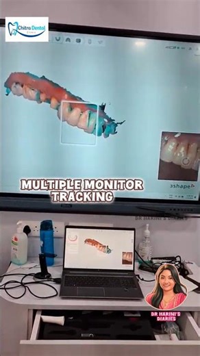 Digital Intraoral Scanning with Trios 3Shape® 🦷🔍- Dr Harini's Diaries ✨