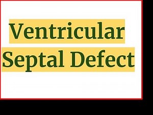 Ventricular Septal Defect