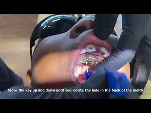 Can't Turn Expander- Stuck?