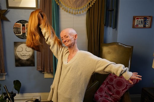 Woman Talks Living with Rapid-Aging Disease (Exclusive)