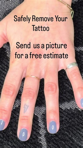 Remove Tattoos Safely with PicoWay Laser Technology
