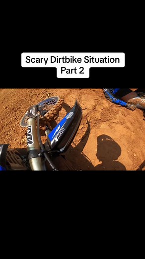 Motocross Rider Crashes Hard Part 2 #fyp #moto #motocross #motorcyclecrash #dirtbikecrash #crash #paramedic #trauma #scary #viral #foryou #dirtbike