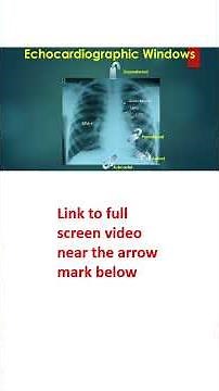 Basic Echocardiographic Views