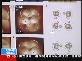 [视频]我科学家首次拍到水分子内部结构
