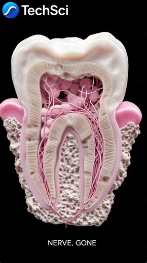 Root Canal Kese Hota Hai?