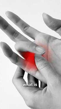 #1/3 What is Trigger Finger ?